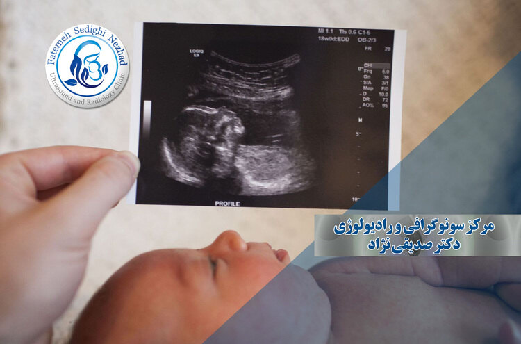 سونوگرافی غربالگری سه‌ماهه اول و دوم: نکات ضروری برای مادران باردار در یاسوج
